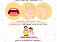 Gobierno de Chiautempan atiende reportes por presunto brote de Coxsackie en San Rafael Tepatlaxco