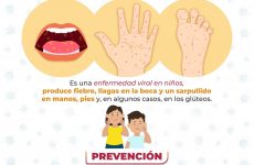 Gobierno de Chiautempan atiende reportes por presunto brote de Coxsackie en San Rafael Tepatlaxco
